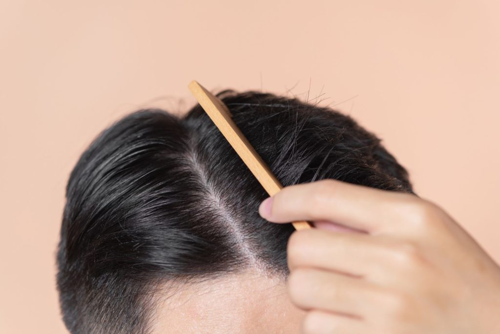 PRP for Hair Rejuvenation