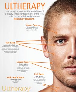 Ultherapy for Men