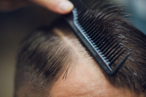 PRP hair therapy for men