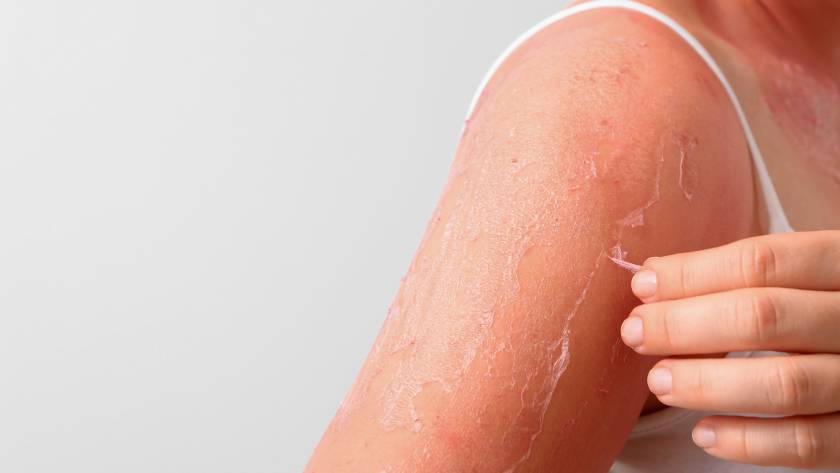ipl photofacial delaware