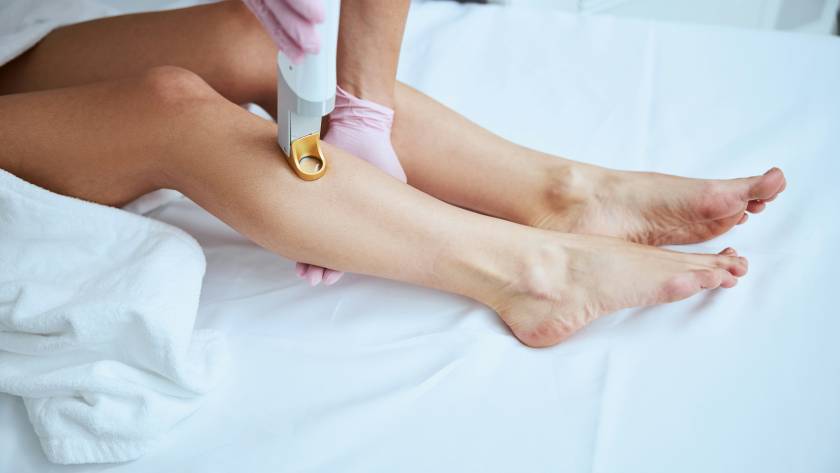 does laser hair removal last forever
