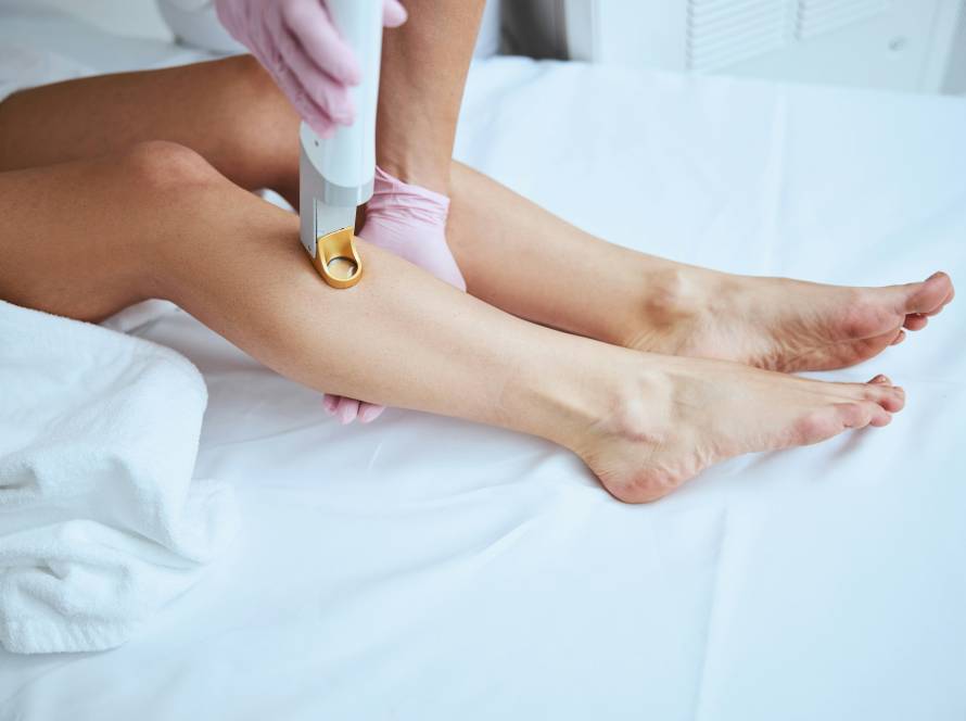 does laser hair removal last forever